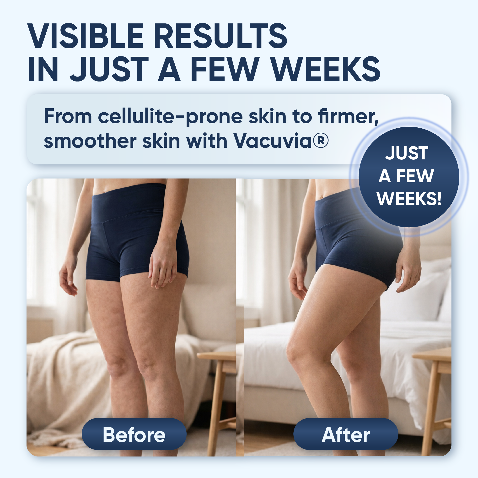 Vacuvia® SculptGlow™ – Firmer, More Toned Skin